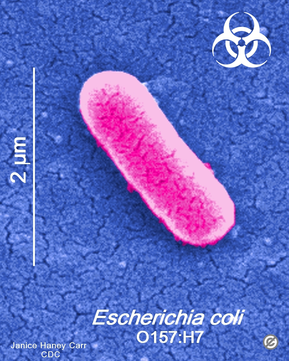 E.coli O157 H7